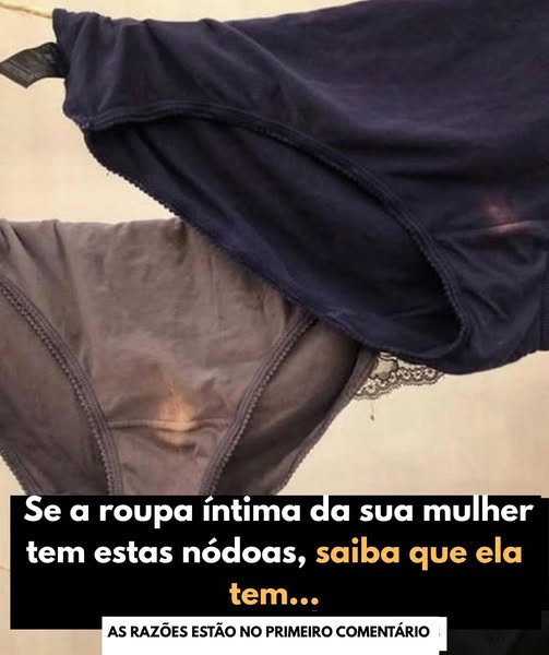 Se a Roupa Íntima da Sua Mulher Tem Estas Nóduloas: Um Guia Completo para Entender o que Elas Significam
