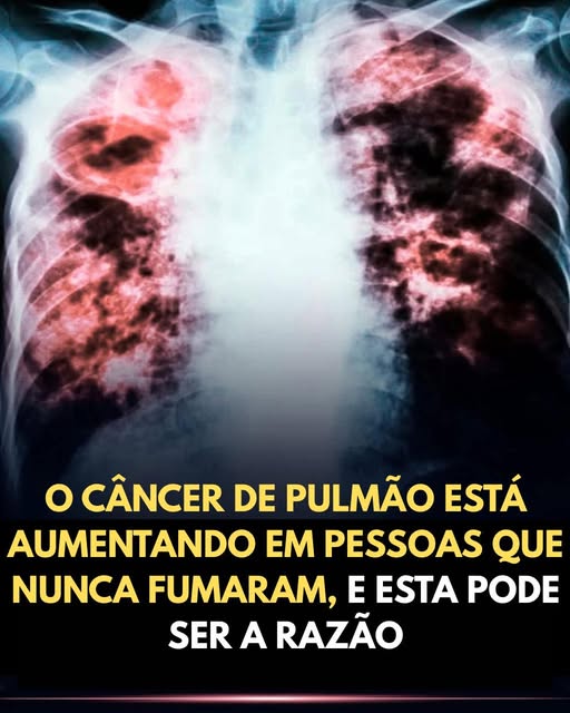 Desvendando o Câncer de Pulmão: Causas, Prevenção e um Guia Prático para a Saúde Respiratória