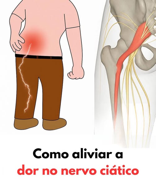 Técnica Simples para Dizer Adeus às Dores na Coluna e Ciática: Um Guia Completo