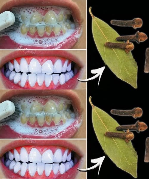 Remova o Tártaro e Clareie os Dentes Naturalmente em Poucos Minutos: Um Guia Completo