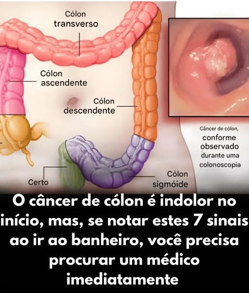 Atenção à Saúde Intestinal: 7 Sinais de Alerta ao Ir ao Banheiro que Você Não Pode Ignorar
