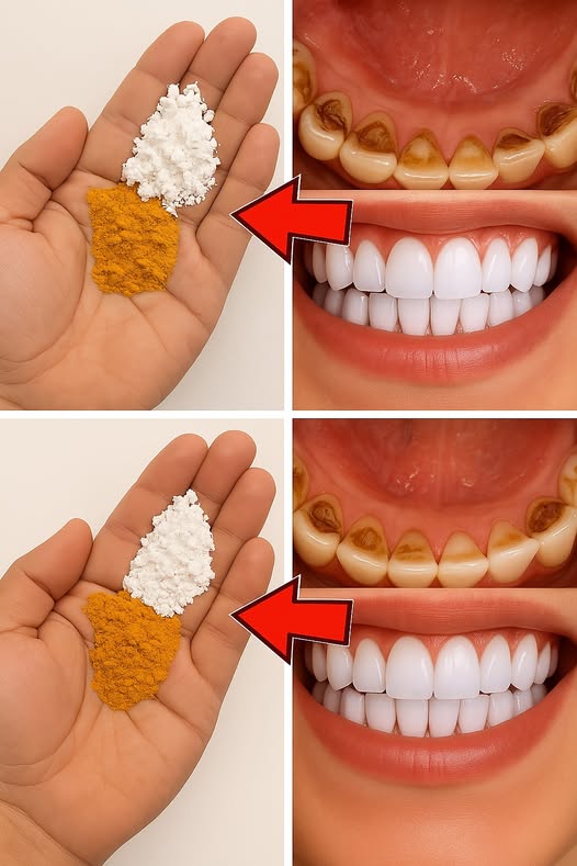 Como Clarear Seus Dentes em Apenas 2 Minutos com Ingredientes Que Você Tem em Casa