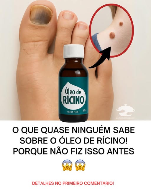 O Segredo Revelado: O Que Quase Ninguém Sabe Sobre o Óleo de Rícino!