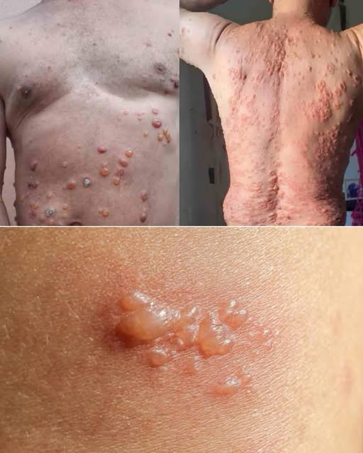 O Hábito que Sabota Sua Pele Enquanto Você Dorme: Guia Completo Para Uma Pele Radiante