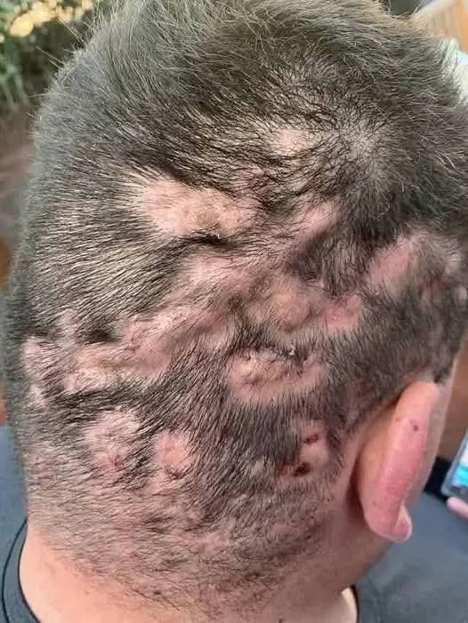 Sinais de Alerta Precoce: Sinais de Que Sua Saúde Está em Risco – Um Guia Detalhado